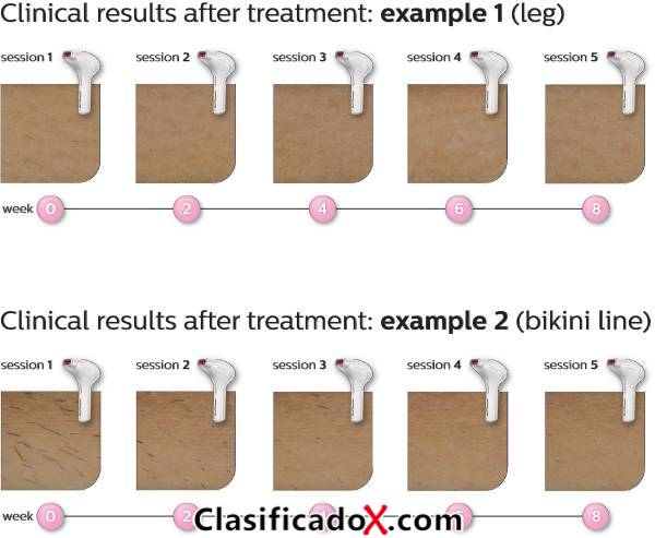 ClasificadoX - Anuncios clasificados relax y contenido erótico