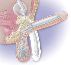 verdadero masaje  prostatico con lugar  domingo  en promocion