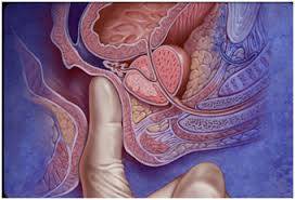 CUENTO  CON  LUGAR   MASAJE  PROSTATICO