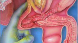 MASAJE  PROSTATICO  CUENTO CON LUGAR  TODO  SERVICIO  COMPLETO  1800