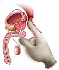 masaje  prostatico para caballeros  con  erecsiones no duraderas y flasidas