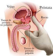 masaje  prostatico  1500   no te vengas  rapido  dura  mas   se dobla  aumenta  tu  dureza